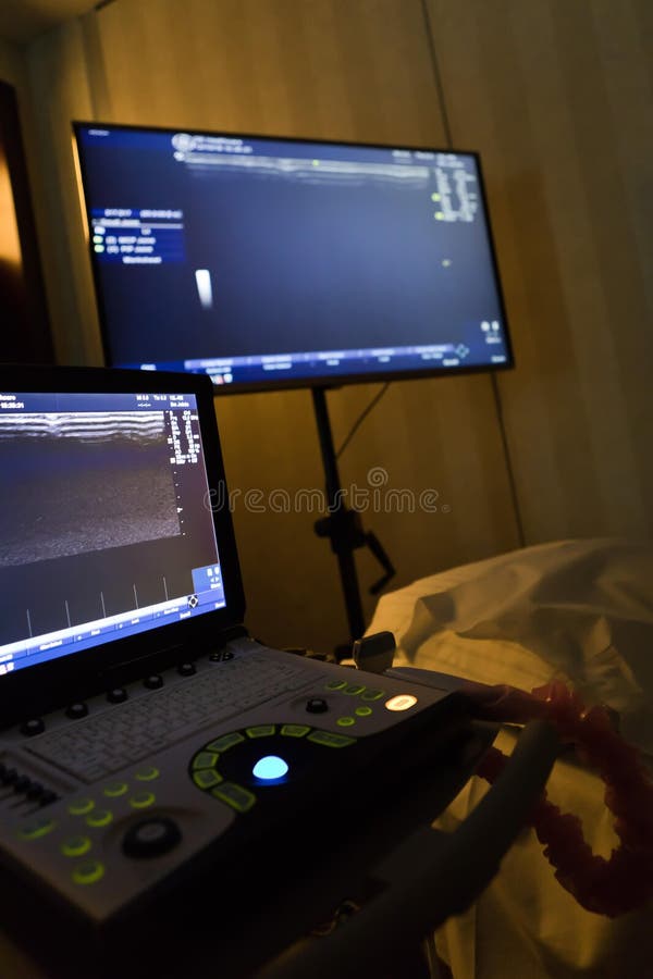 Sonografía real, exploración ultrasónica portátil en sitio oscuro imágenes de archivo libres de regalías Sonografía real, exploración ultrasónica portátil en sitio oscuro imágenes de archivo libres de regalías