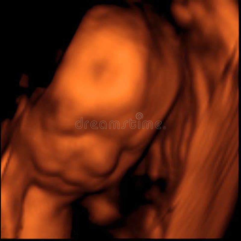 Sonogram 3D imágenes de archivo libres de regalías