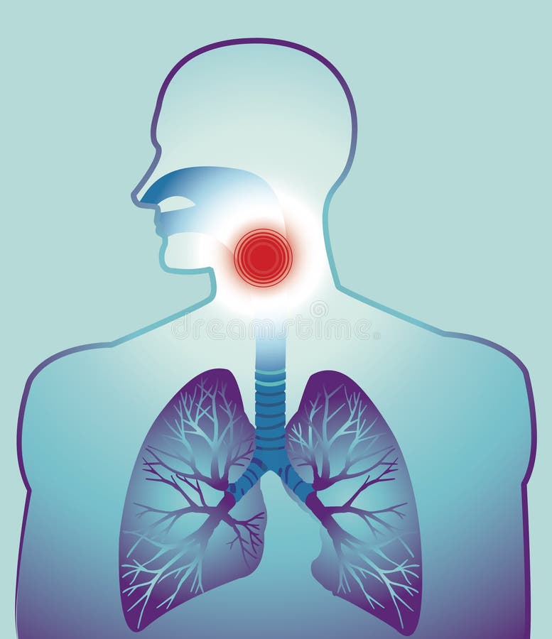 Vector illustration of person with detailed drawing of lungs,and sore throat.