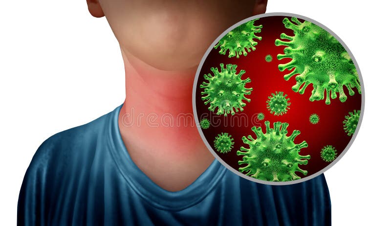Sore throat infection as a neck with microscopic germ anatomy close up as a symbol for flu or influenza sickness with 3D vector illustration
