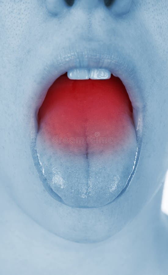Sore Throat, Shown Red, Keep Handed Stock Photo Image of adults