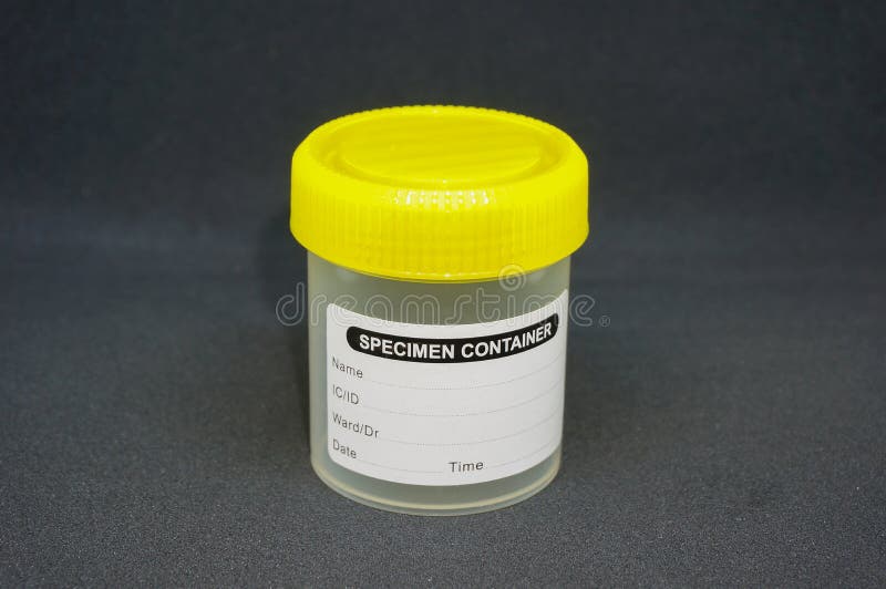 Medical urine dipstick stock image. Image of close, color 87513801