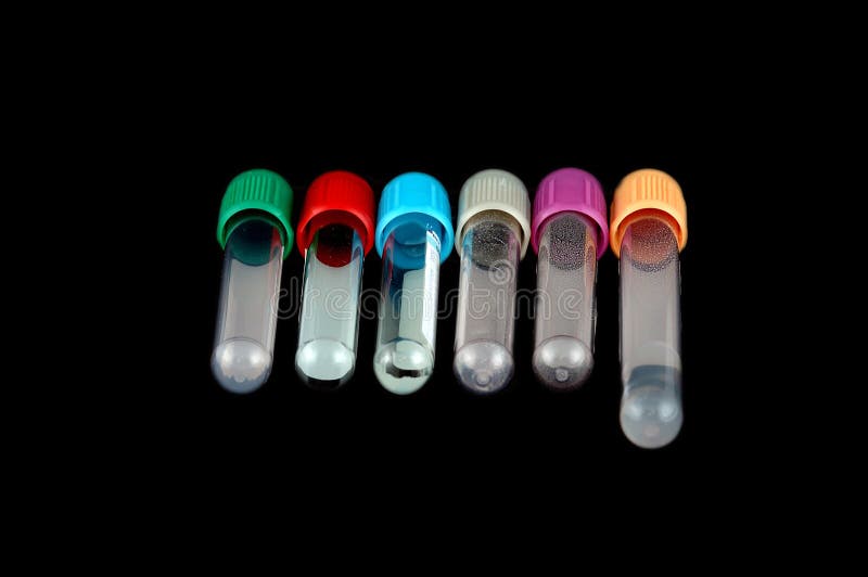 Specimen tube stock photo. Image of tests, specimen, pathology 613458