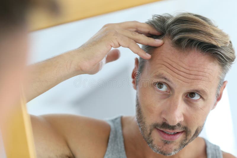 Spiegelporträt des Mannes betroffen durch Haarausfall