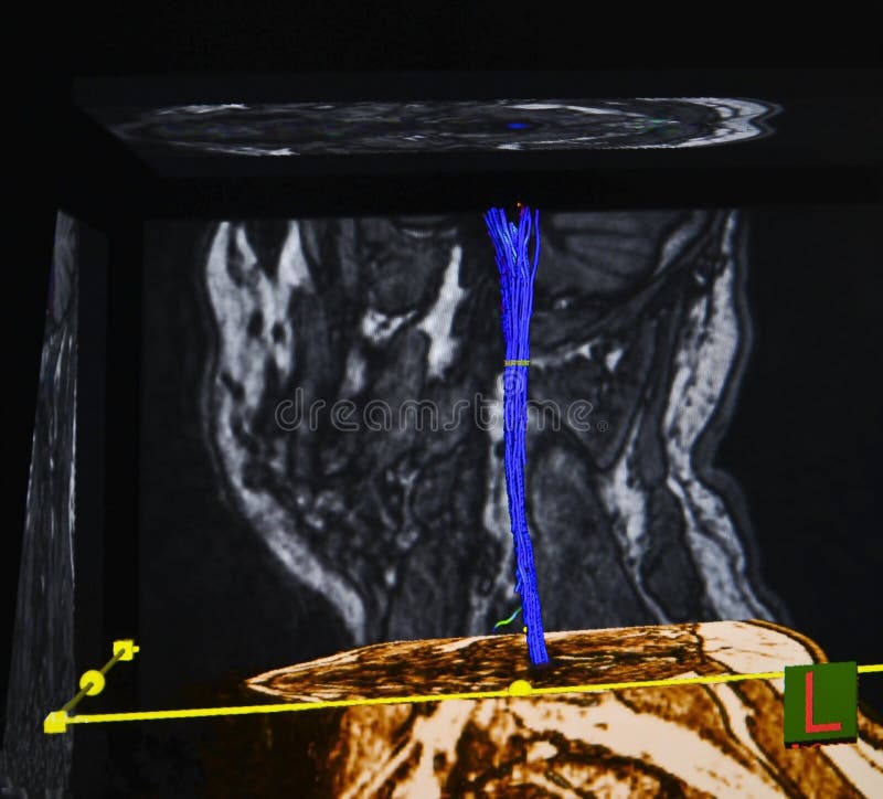 Dos En Uno (muñeca Y Manta De 1 M X 1,7 M), Peluche De Hámst - Foto 3