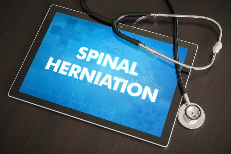 Spinal herniation (congenital disorder) diagnosis medical concept on tablet screen with stethoscope.