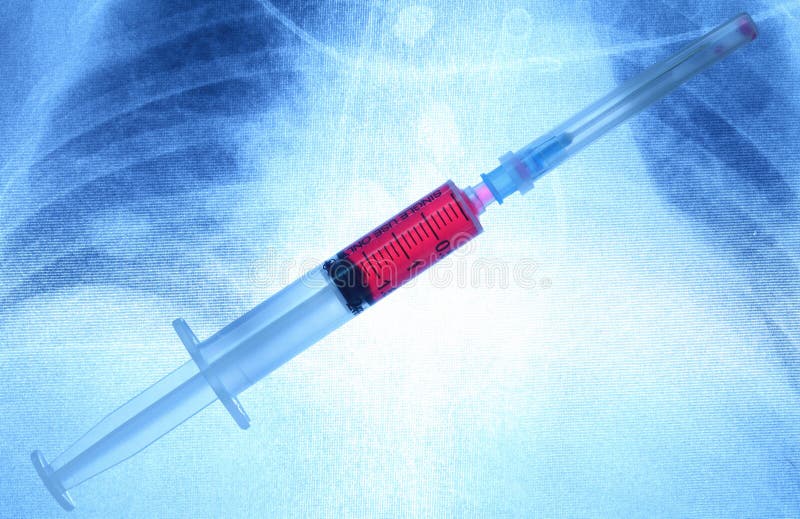 Spuit op een x-ray röntgenstraal royalty-vrije stock afbeeldingen Spuit op een x-ray röntgenstraal royalty-vrije stock afbeeldingen