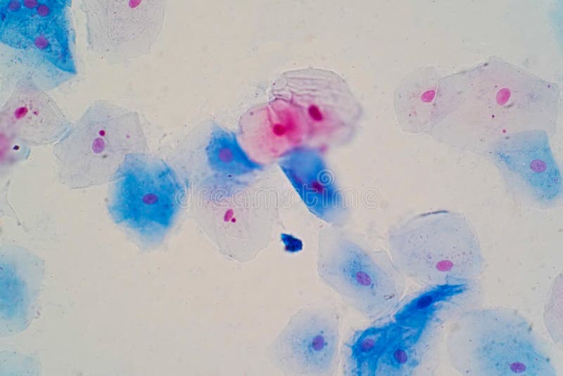 Squamous epitheliaale cellen onder microscoopmening voor onderwijs hallo stock foto Squamous epitheliaale cellen onder microscoopmening voor onderwijs hallo stock foto