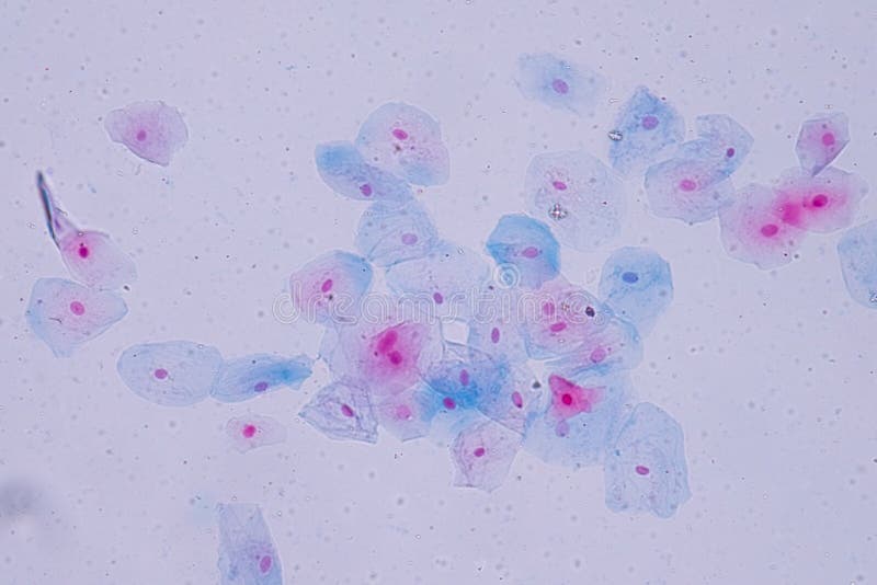 Squamous покровные клетки под взглядом микроскопа для образования высокого стоковое фото rf Squamous покровные клетки под взглядом микроскопа для образования высокого стоковое фото rf