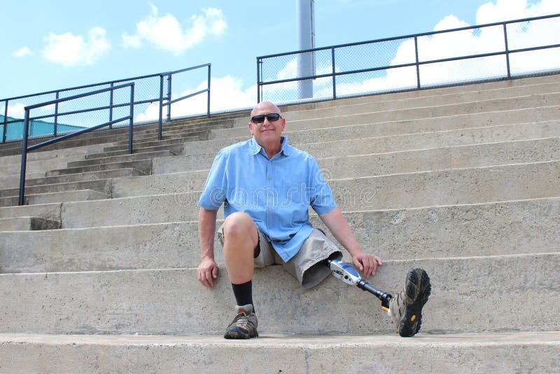 Standing man with prosthetic leg, detail