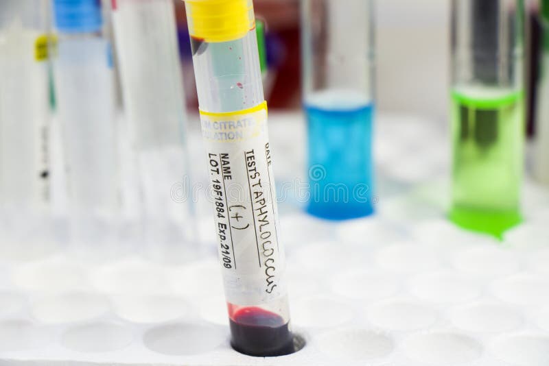 Staphylococci Bacteria, Blood Test Tube Samples, Laboratory and