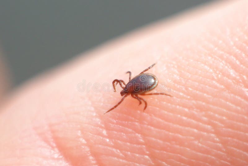 Close photo of Ixodes ricinus tick who has reached the human skin. Seeking right spot to take a bite.Ticks are parasites who are using blood of other mammals and birds to surviv. Unfortunately they spread diseases like Lyme disease and fevers. Close photo of Ixodes ricinus tick who has reached the human skin. Seeking right spot to take a bite.Ticks are parasites who are using blood of other mammals and birds to surviv. Unfortunately they spread diseases like Lyme disease and fevers.