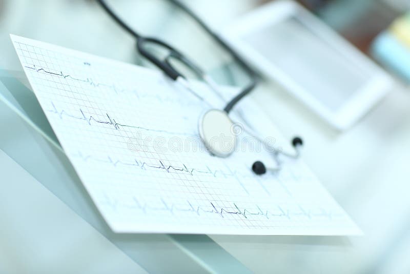 Stethoscope and cardiogram on a medical table