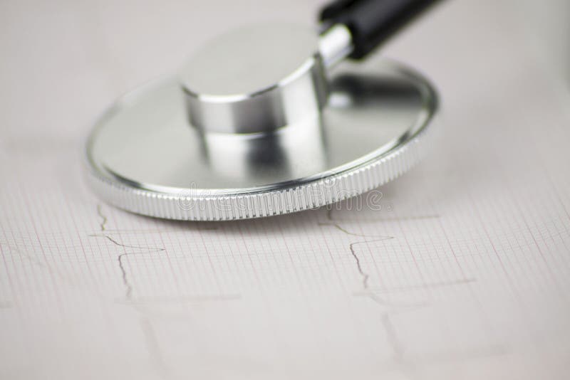 Stethoscope on an EKG Sheet Depicting a Cardiology Check Stock Photo