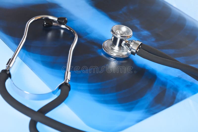 Stethoscope and Xray Image of Lungs. Stock Photo Image of xray