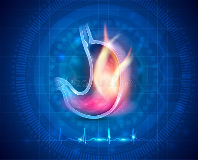 Stomach Disorder, Nausea or Vomiting, Isolated Child with Sickness