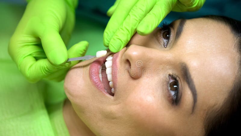 Stomatologist die kleur van natuurlijke tand met dichtingsproduct het vullen, close-up vergelijken stock afbeeldingen Stomatologist die kleur van natuurlijke tand met dichtingsproduct het vullen, close-up vergelijken stock afbeeldingen