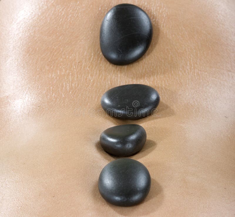 Stone Therapy Picture. Image 6102224