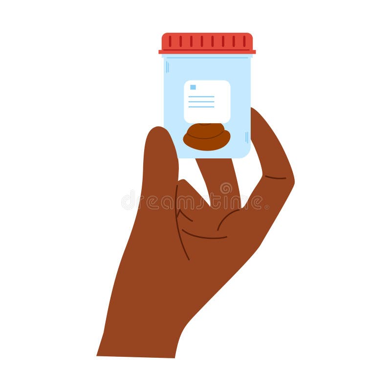 Stool analysis. Poop test. Plastic container with biomaterial for laboratory analysis on african hand royalty free illustration