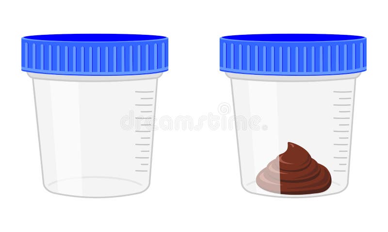 Stool sample, empty and full plastic cups. Poop analysis. Laboratory examination concept. Vector cartoon illustration royalty free illustration