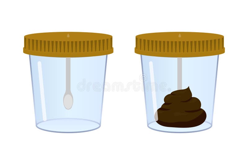 Stool sample in medical container and empty container with spoon stock illustration