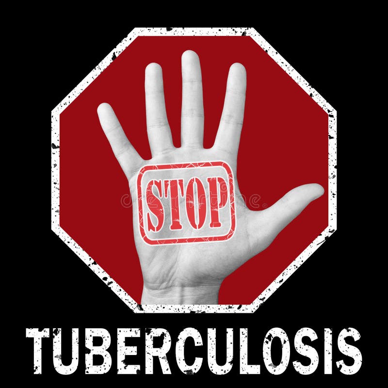 Stop Tuberculosis Disease. Infographics Banner Stock Vector
