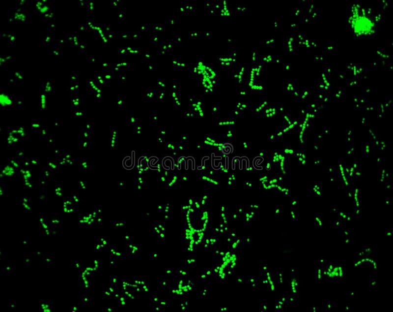 Microscopic photography of aStreptococcus viridans bacteria culture, a normal bacteria from the mouth, and stained with CFSE for better visualization. It has been photographed at 110 X magnification