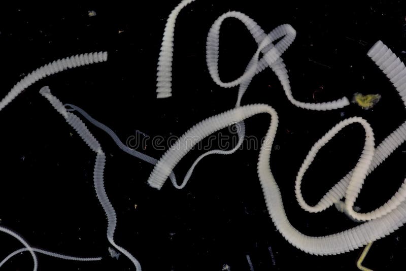 The Study of Tapeworm Infection is Caused by Ingesting Food or Water