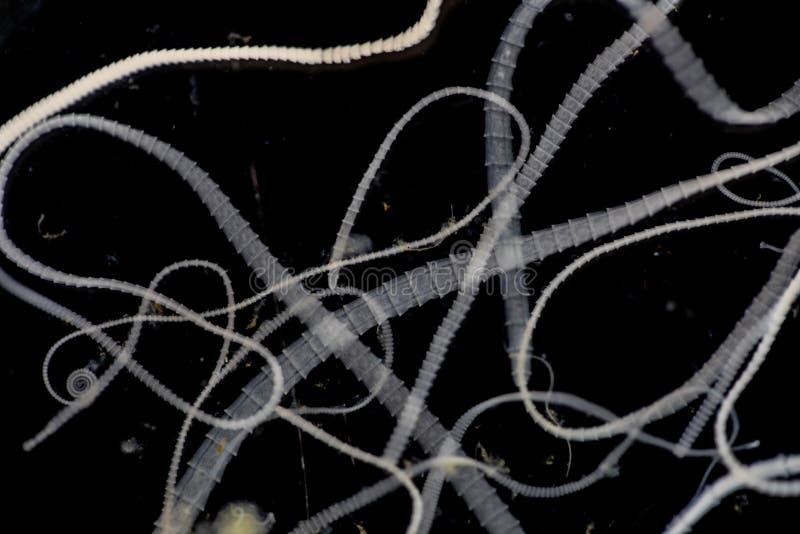 Tapeworm Infection is Caused by Ingesting Food or Water Contaminated