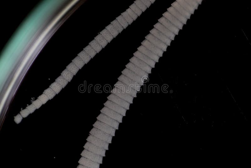 The Study of Tapeworm Infection is Caused by Ingesting Food or Water