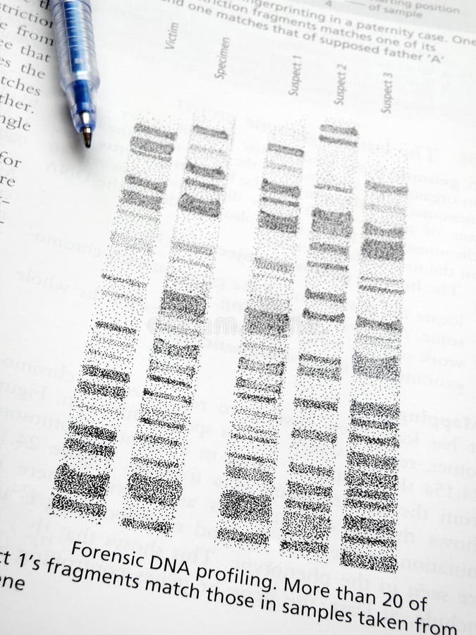 Forensic science - An image of an open medical biology book at the page with DNA code profiles and DNA fingerprint samples. Study of the use of restriction enzymes on genetic chromosomes of suspects to help find the criminal, using comparison of DNA fragments separated by gel chromatography. Tests are carried out in the laboratory room by scientists. DNA codes pattern formed on chromatograph is unique to each person, to a very high degree of accuracy. Analogous to genetic finger printing. Vertical color image. Forensic science - An image of an open medical biology book at the page with DNA code profiles and DNA fingerprint samples. Study of the use of restriction enzymes on genetic chromosomes of suspects to help find the criminal, using comparison of DNA fragments separated by gel chromatography. Tests are carried out in the laboratory room by scientists. DNA codes pattern formed on chromatograph is unique to each person, to a very high degree of accuracy. Analogous to genetic finger printing. Vertical color image.