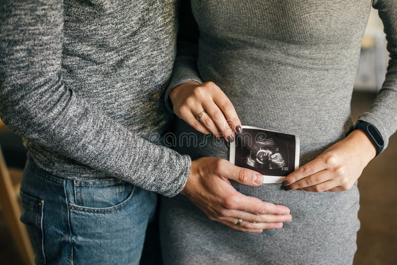 Stylish pregnant couple holding ultrasound scan of baby on baby bump. Healthy young parents holding in hands on belly photo of stock photography