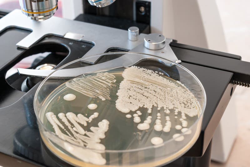 Stäng sig upp av den petri maträtten på laboratoriummikroskopet arkivfoto