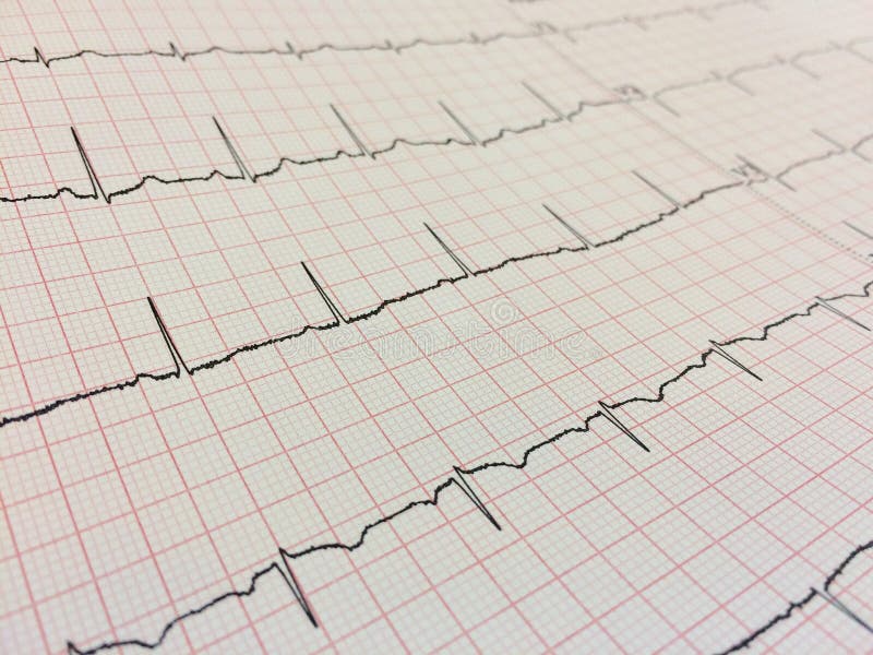 Stäng upp elektrokardiogram, elektrokardiografi eller EKG-diagram royaltyfri bild