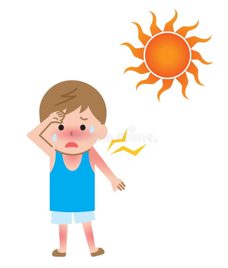 Sun Uv Rays Damage Boy Kid Skin Illustration. Isolated on White Background Stock Vector - Illustration of heat, sunbeam: 147407776 Sun Uv Rays Damage Boy Kid Skin Illustration. Isolated on White Background Stock Vector - Illustration of heat, sunbeam: 147407776