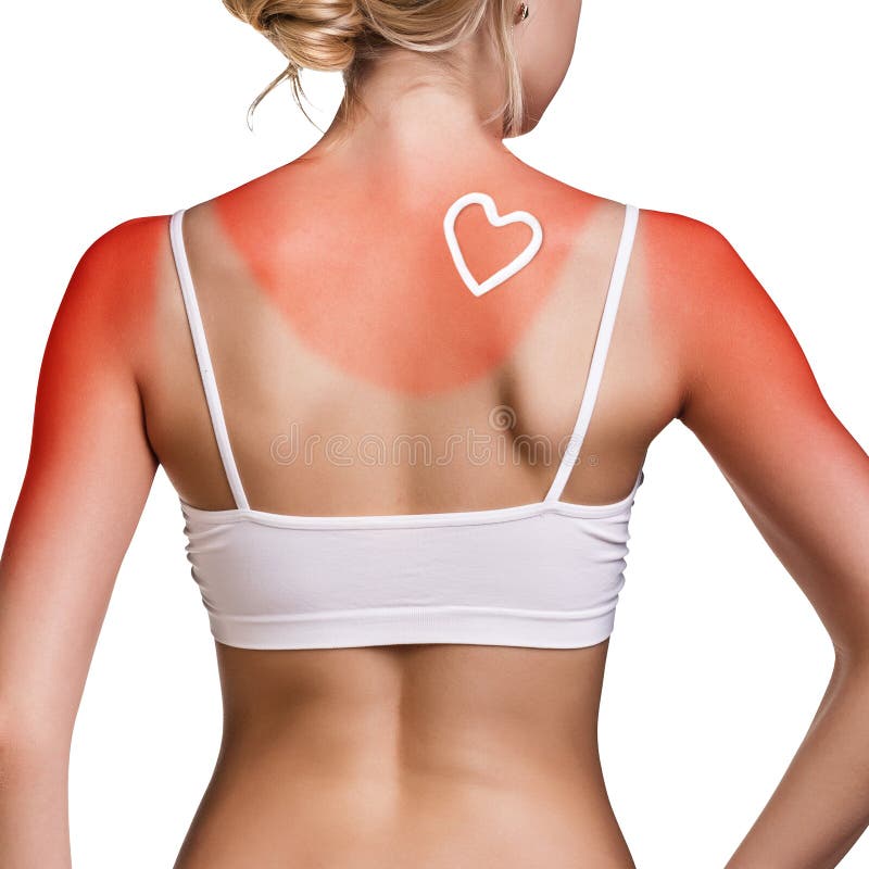 Sunblock på den kvinnliga skuldran arkivfoton Sunblock på den kvinnliga skuldran arkivfoton