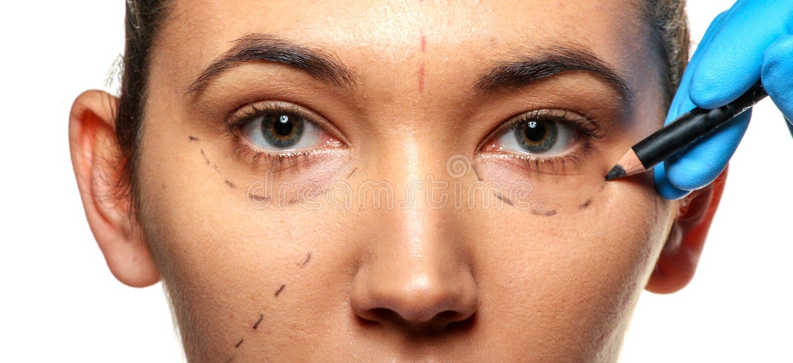 Survey before plastic surgery. royalty free stock photo
