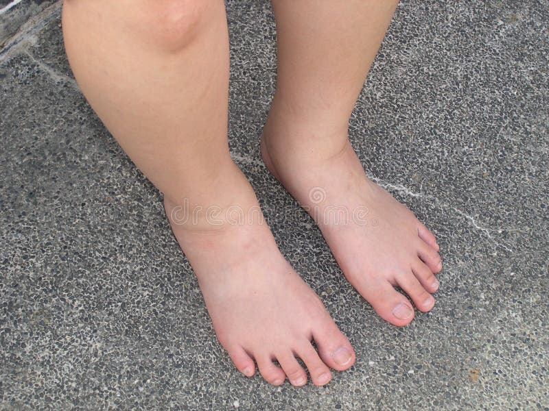 Gambe in gravidanza di lady causato dalla ritenzione idrica.