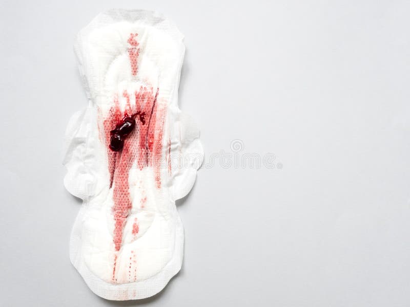 Symptom of Endometriosis, Menstrual Blood with Blood Clots on a Sanitary  Pad Stock Image - Image of feminine, menstruation: 207937991