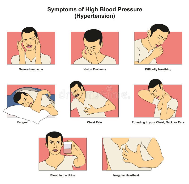 hypertension headache signs