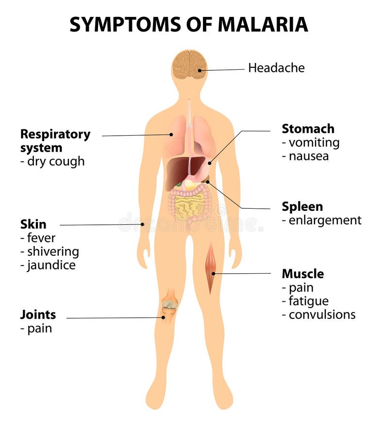 what are symptoms of malaria