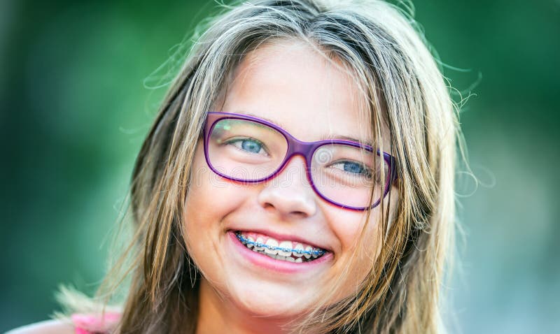 Szczęśliwa uśmiechnięta dziewczyna z stomatologicznymi brasami i szkłami Młoda śliczna caucasian blond dziewczyna jest ubranym zę zdjęcia royalty free