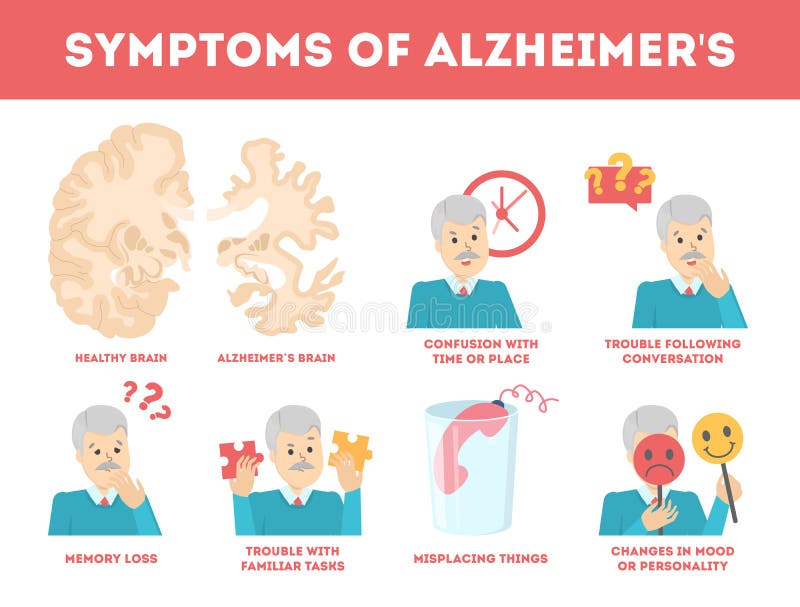 Síntomas de la enfermedad de Alzheimer infographic Pérdida y problema de memoria