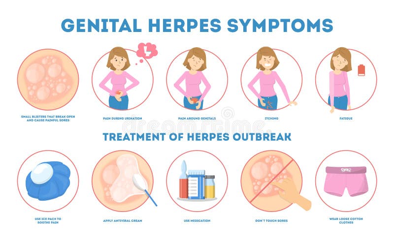 Síntomas del herpes genital Ejemplo infeccioso de la enfermedad de la dermatología