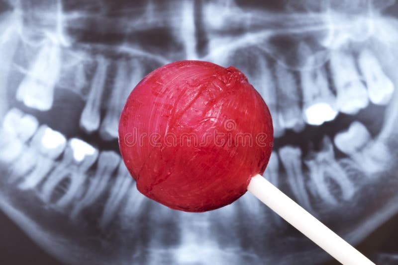 Red lollipop in front of a damaged set of teeth. Red lollipop in front of a damaged set of teeth