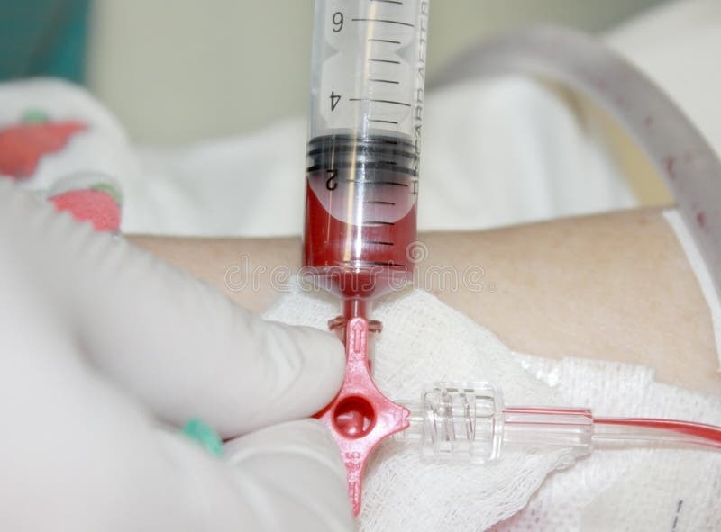 Blood Test. Extraction Of Blood Stock Image Image of hematologist