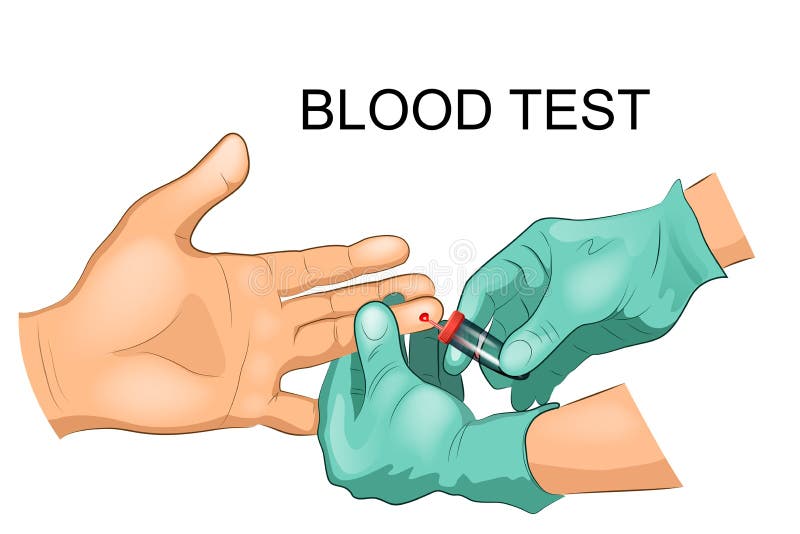 The taking of blood from a finger for analysis stock illustration The taking of blood from a finger for analysis stock illustration