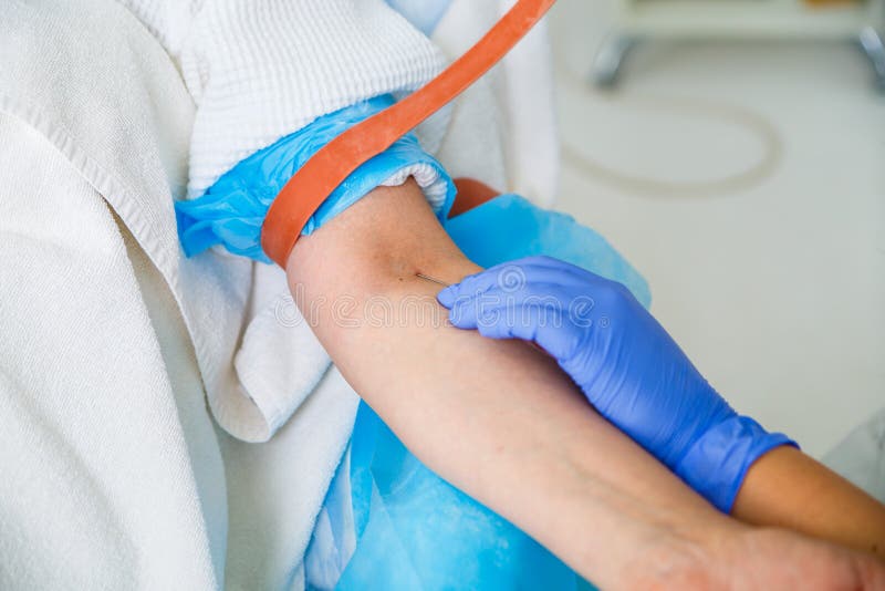 Taking a blood sample stock image. Image of nurse, disease 86312263