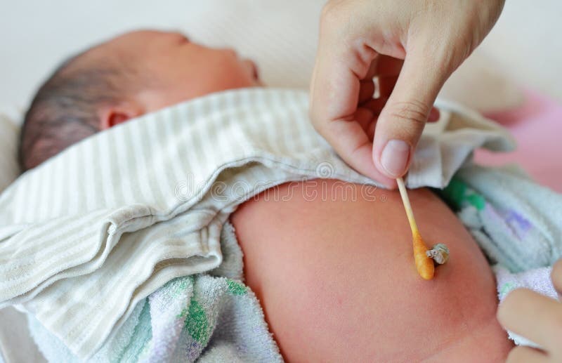 186 Cordon Ombilical De Bebe Nouveau Ne Photos Libres De Droits Et Gratuites De Dreamstime