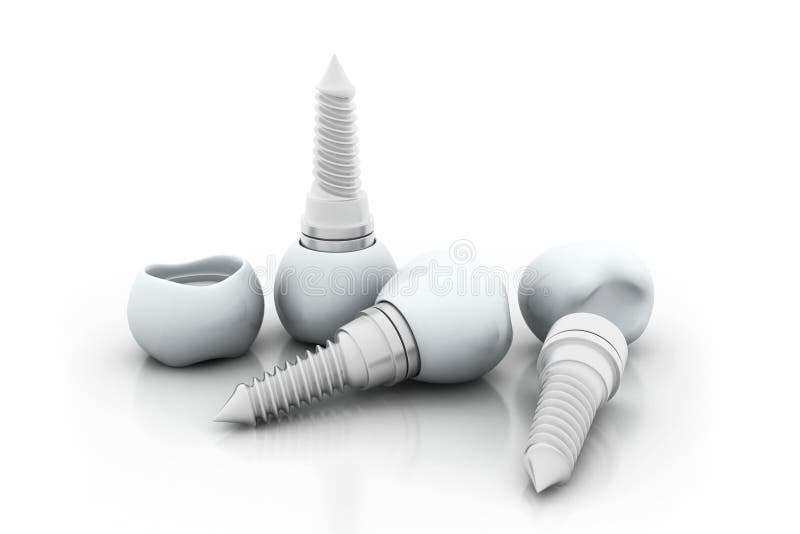 tand- isolerad siktswhite för element implantat royaltyfri illustrationer tand- isolerad siktswhite för element implantat royaltyfri illustrationer